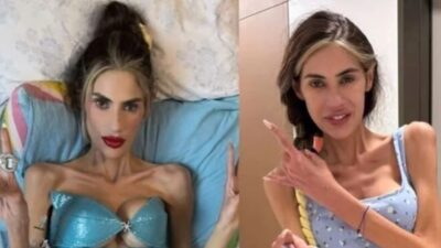 Anoreksiya nervoza rahatsızlığı nedeniyle 25 kilonun altına düşen sosyal medya