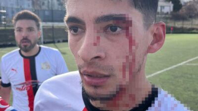 Bilecik’te oynanan Akpınarspor–Gülümbespor karşılaşmasının ardından çıkan kavgada 3 futbolcu yaralandı.