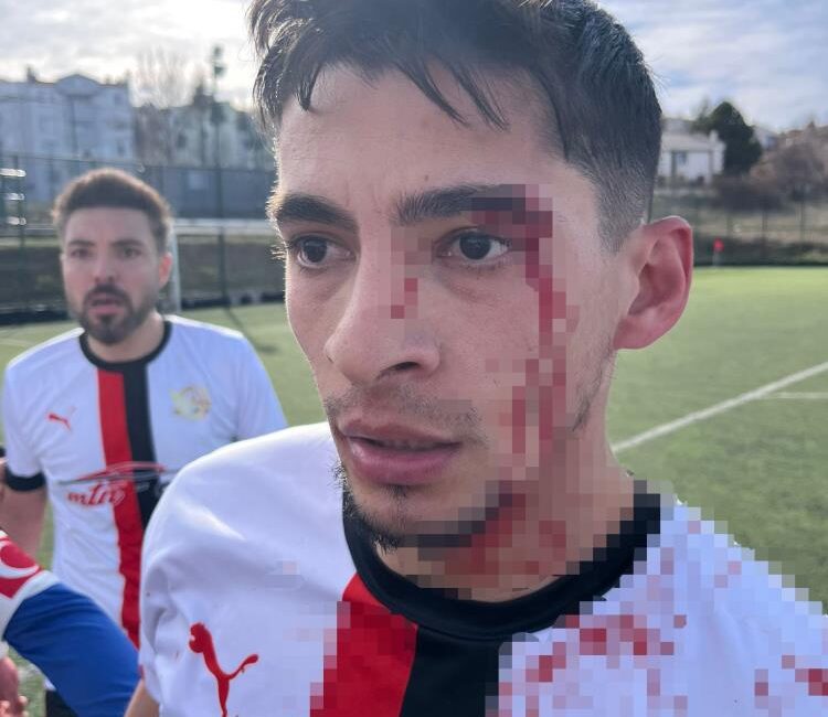 Bilecik’te oynanan Akpınarspor–Gülümbespor karşılaşmasının ardından çıkan kavgada 3 futbolcu yaralandı.