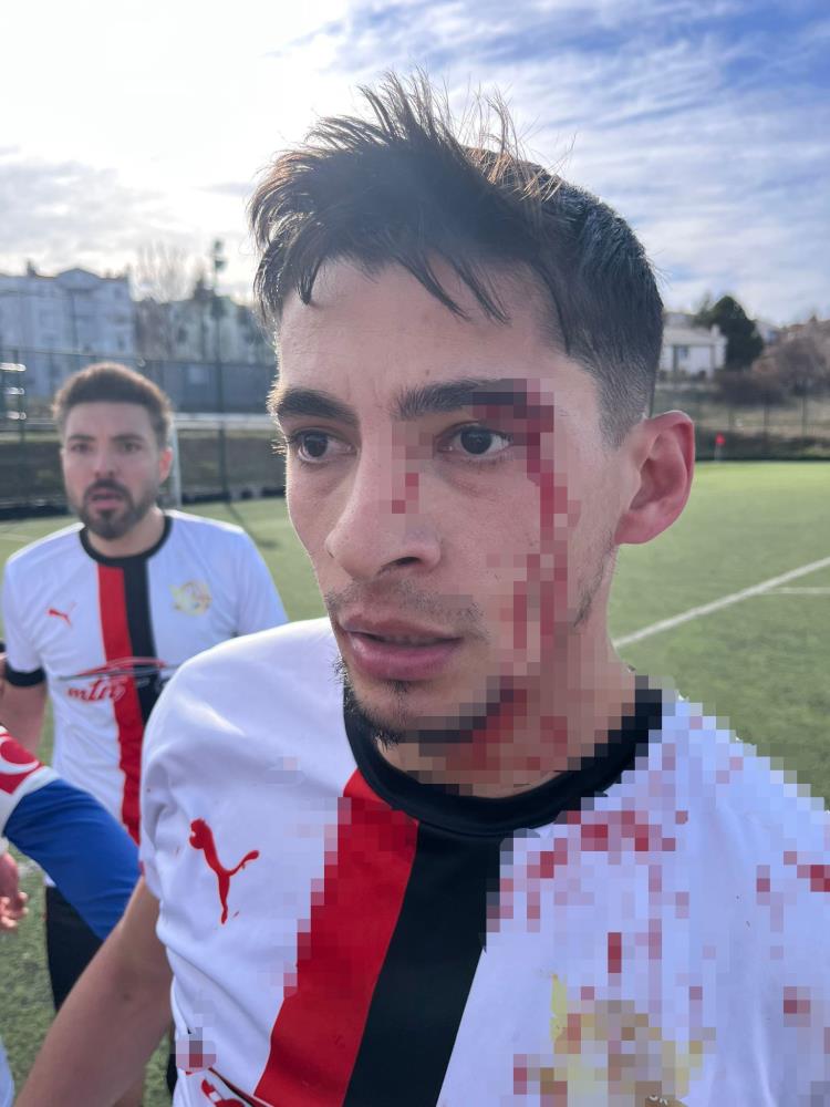 Bilecik’te oynanan Akpınarspor–Gülümbespor karşılaşmasının ardından çıkan kavgada 3 futbolcu yaralandı.