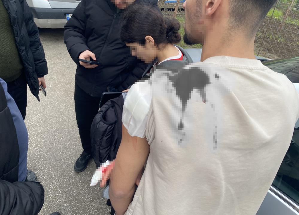 Bir anda büyüdü… kız meselesi kanlı bitti 1 Bursam Medya -